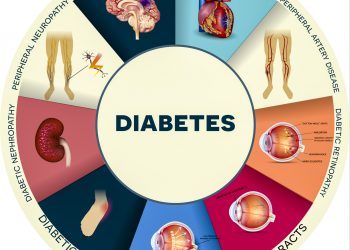 Diabetics With Sepsis A Cause of Worry