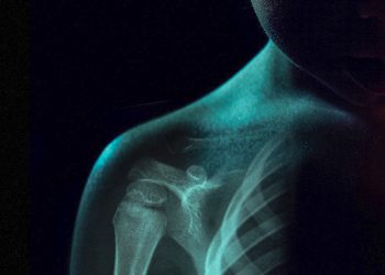 Autoimmune diseases in kids