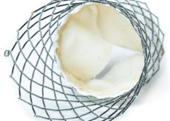 IJN performs innovative heart valve treatment