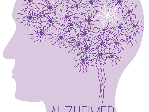 Leaving or living with  Alzheimer’s disease