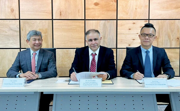 Reszon to make Chembio’s HIV test kits