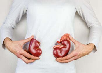 Kidney transplant the viable option