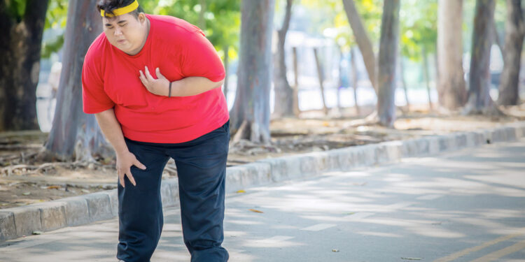Obesity and infection risks